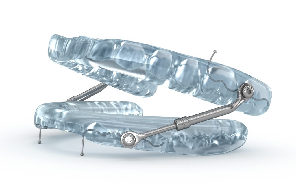 up close picture of an oral appliance
