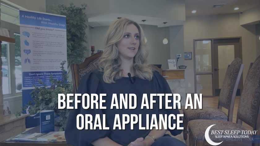 before and after an oral appliance